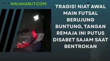 Tragis! Niat Awal Main Futsal Berujung Buntung, Tangan Remaja Ini Putus Disabet Sajam Saat Tawuran di Karawang